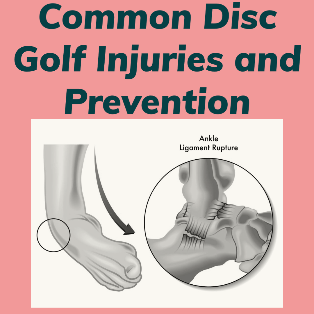 Common Disc Golf Injuries